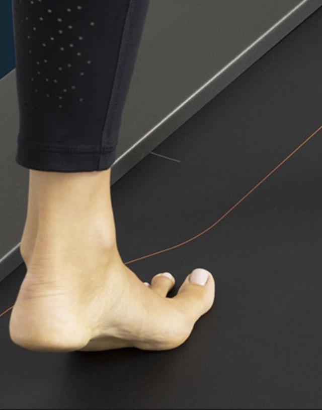 esame barometrico del piede marano di napoli